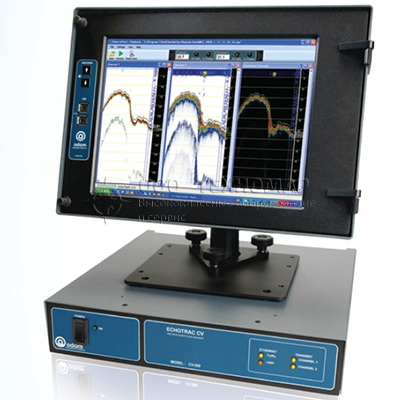 Echotrack CV200 300